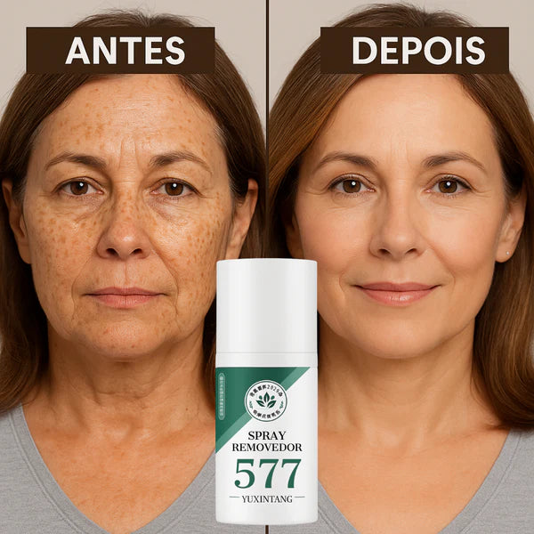 Spray Removedor de  manchas de Sol, IDADE E MELASMA! Desconto+ Frete Grátis